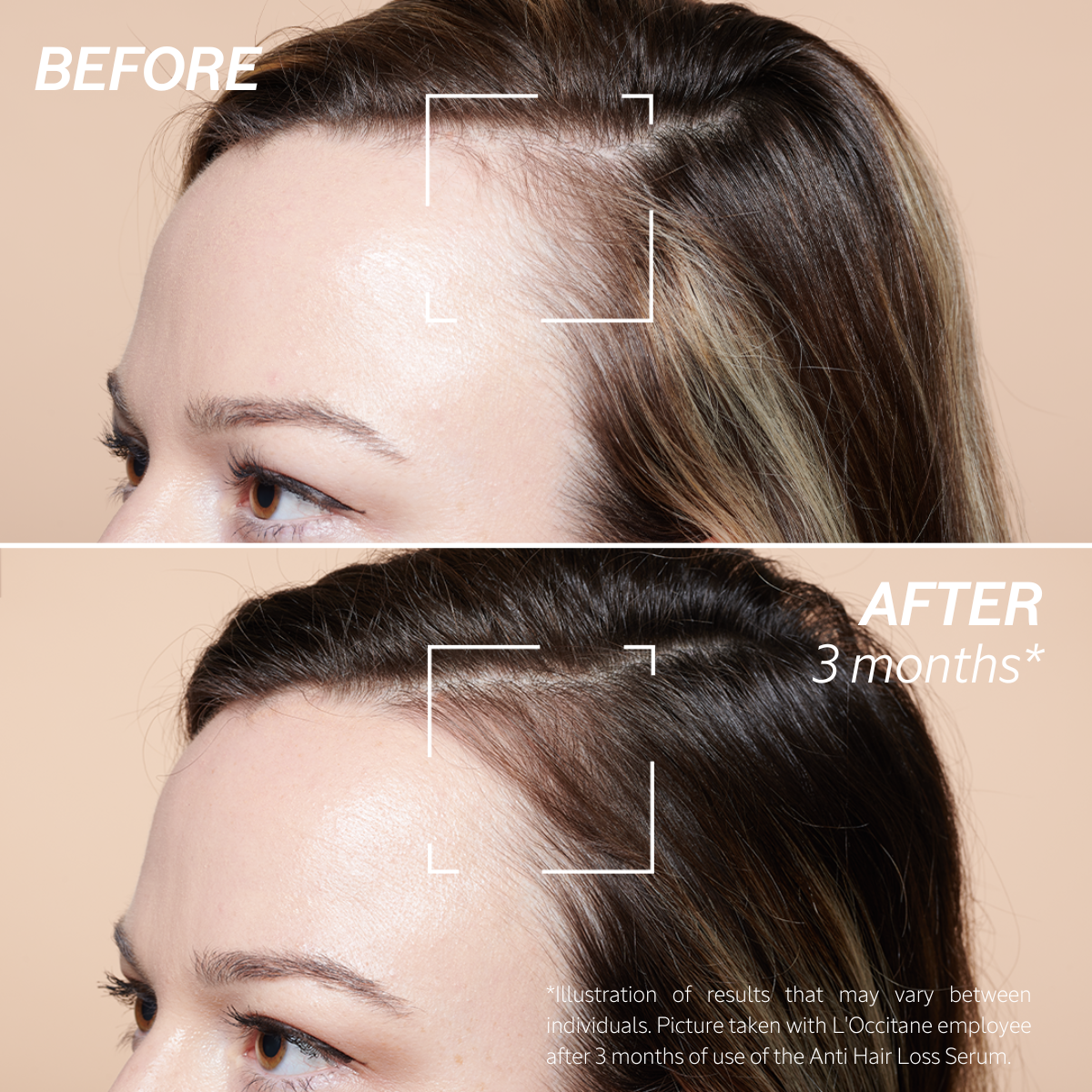 Strength & Volume | Saç tökülməsinə qarşı Serum